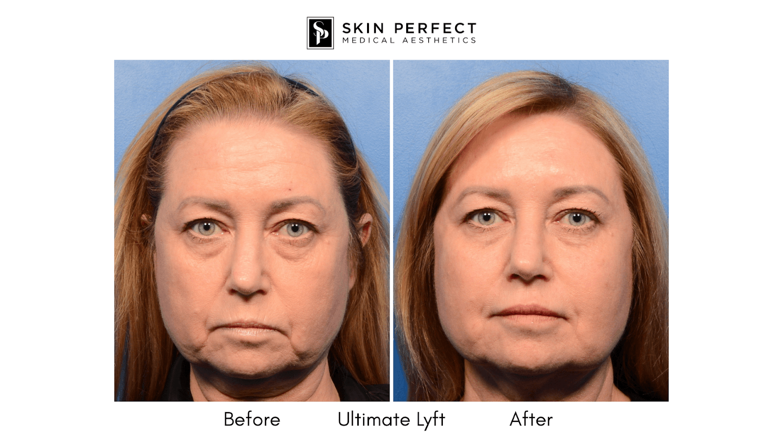 Skin Perfect Medical Aesthetics - photo 1 of 8