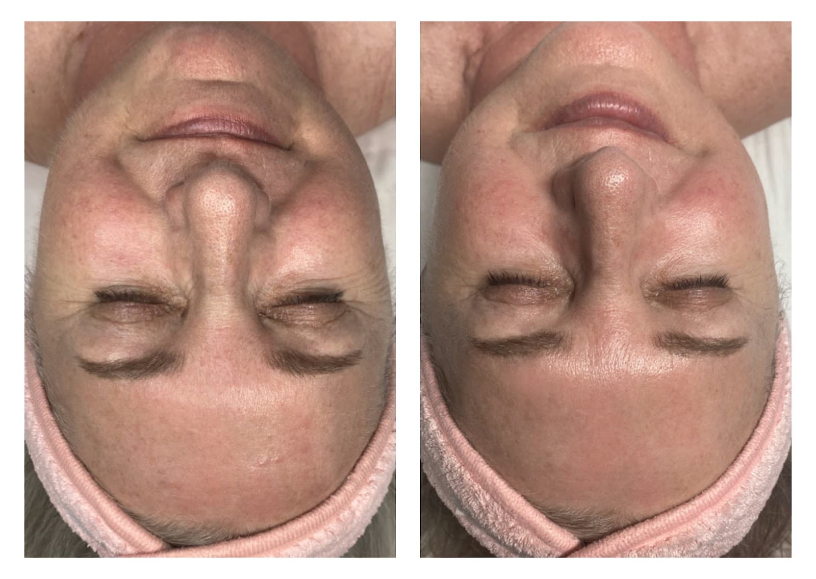 PURE Face Care