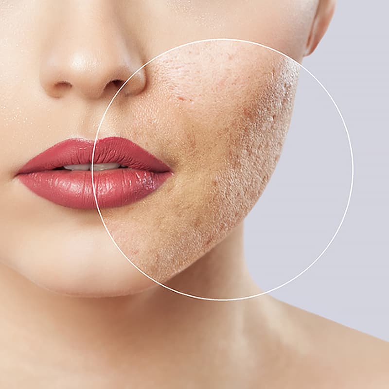 Derick Dermatology - Bartlett
