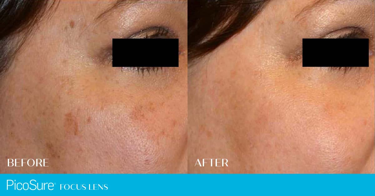 Better U Skin and Body Care Medical Spa
