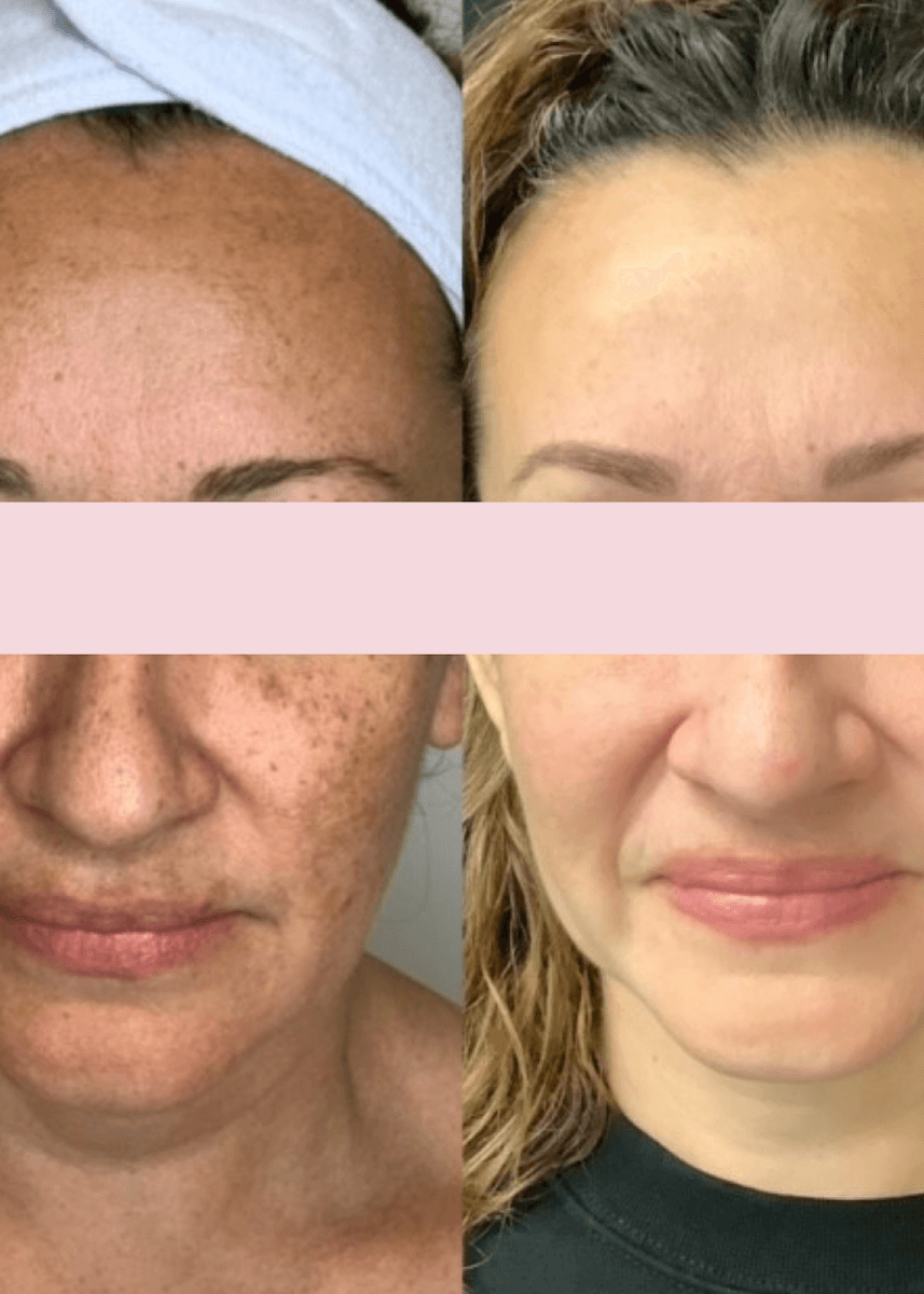 Rejuvenate at Capital Women's Care