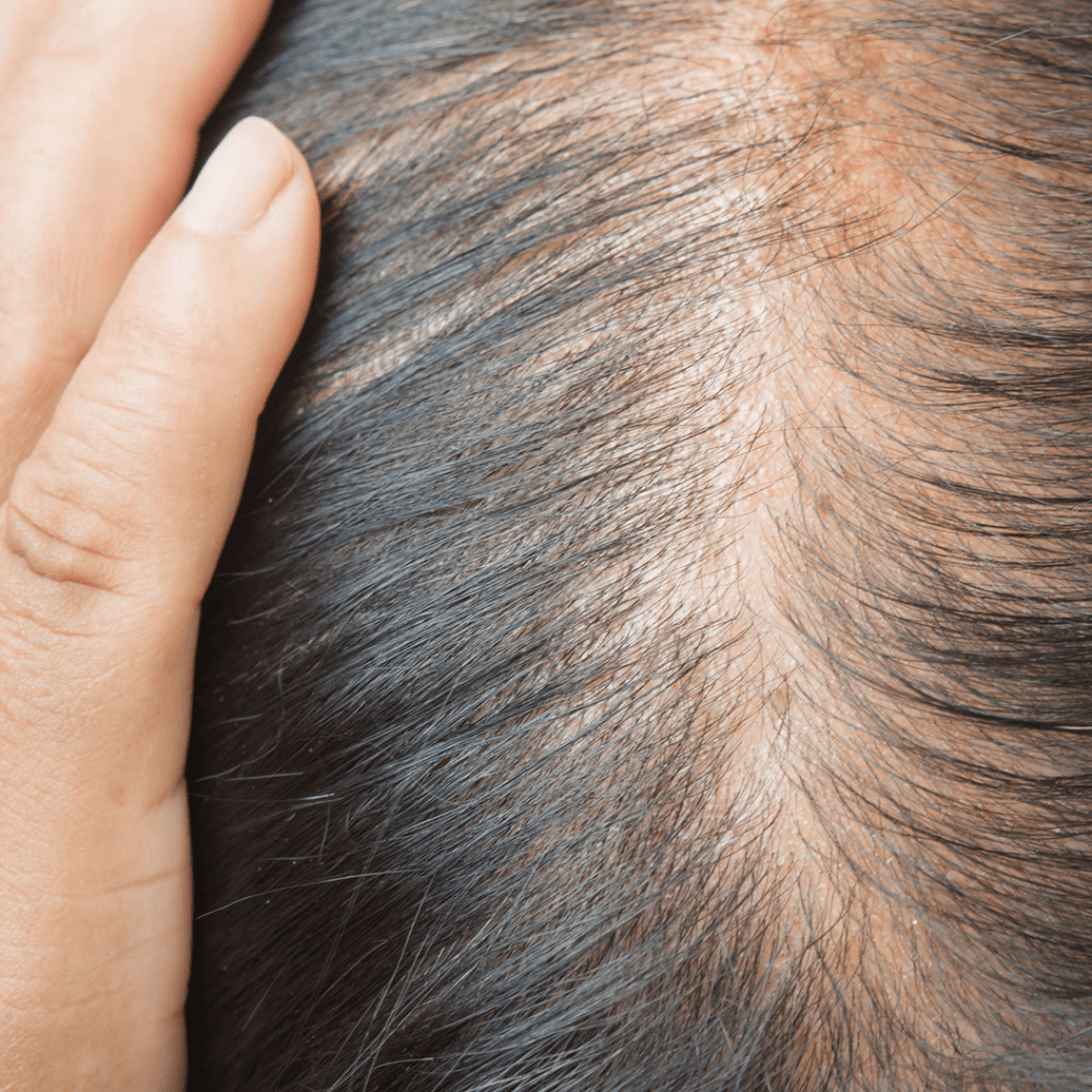 Natural Image Skin Center