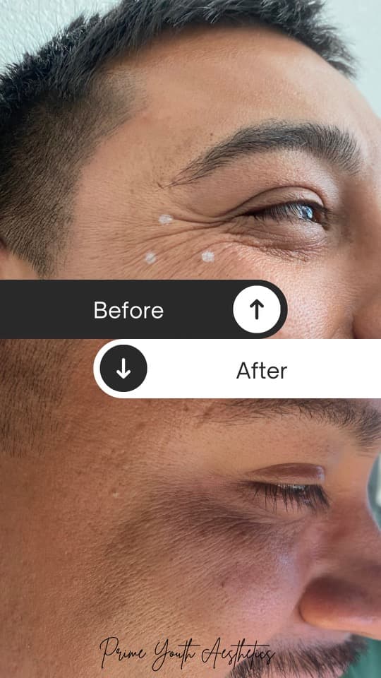 Prime Youth Aesthetics and Wellness