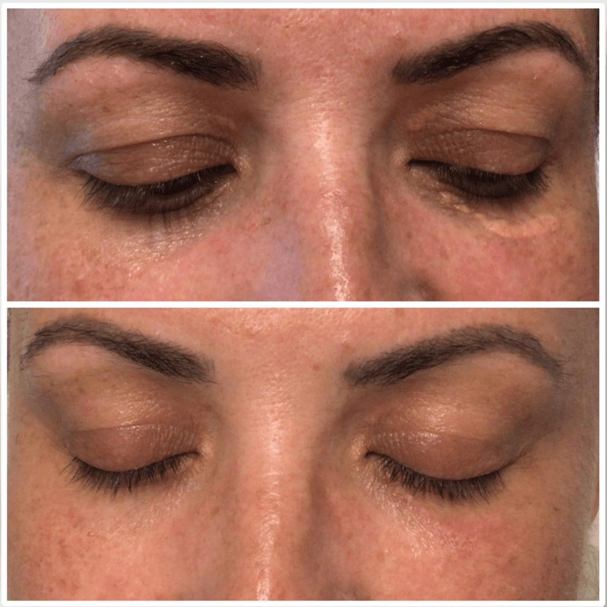 Sand Dermatology