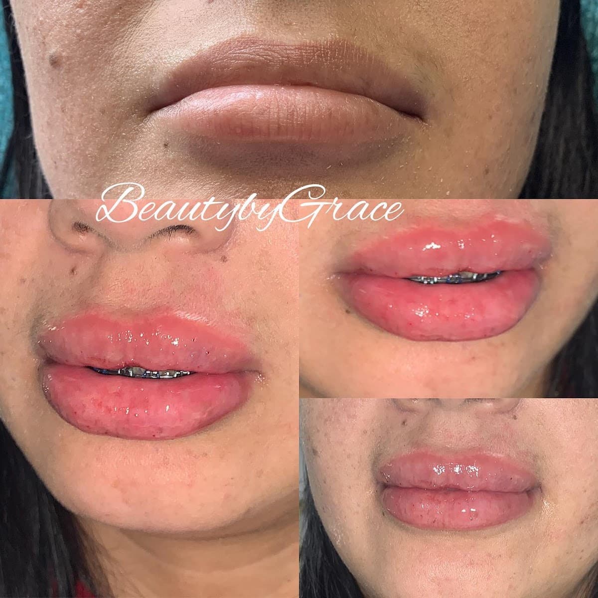 Grace Medspa & Body Solutions