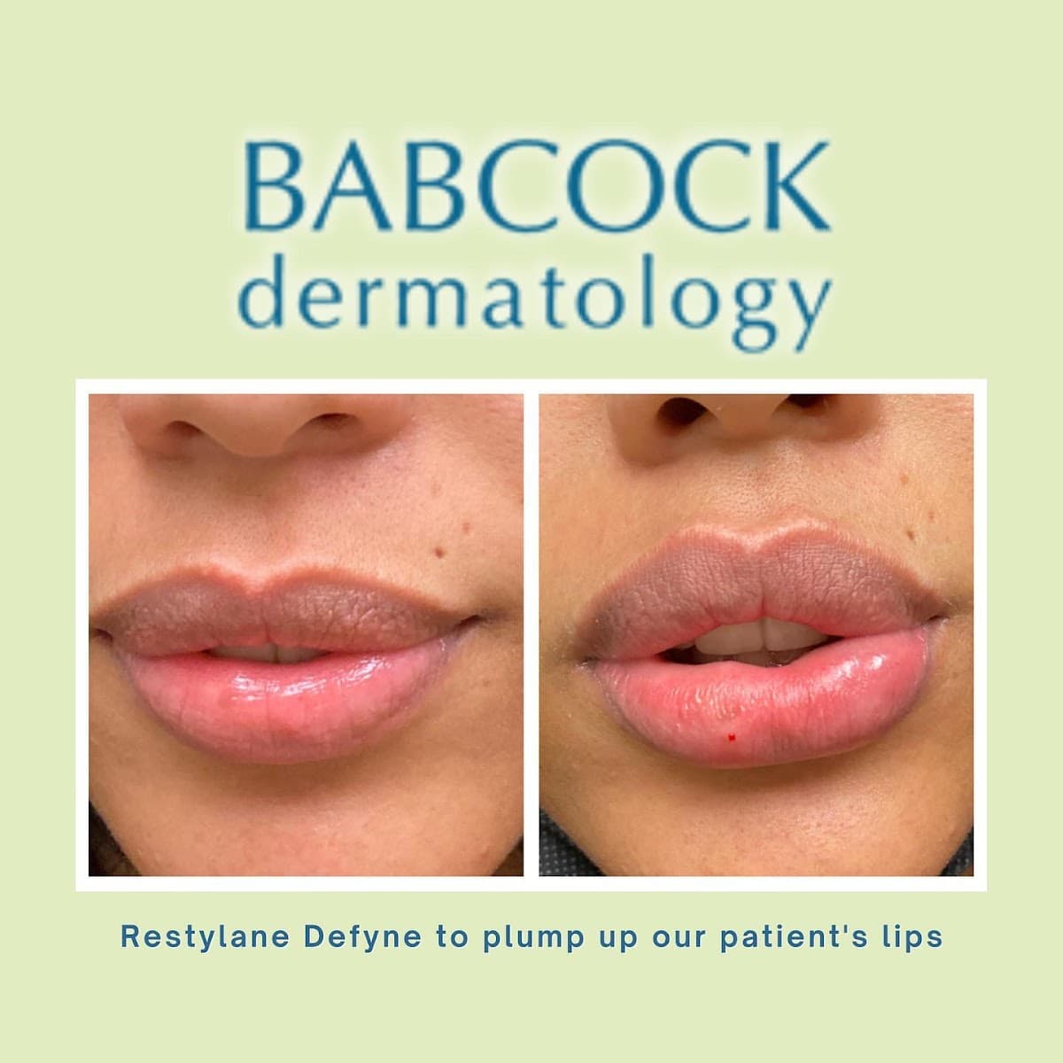 Babcock Dermatology-Atlanta, Buckhead & Sandy Springs photo 1 of 8
