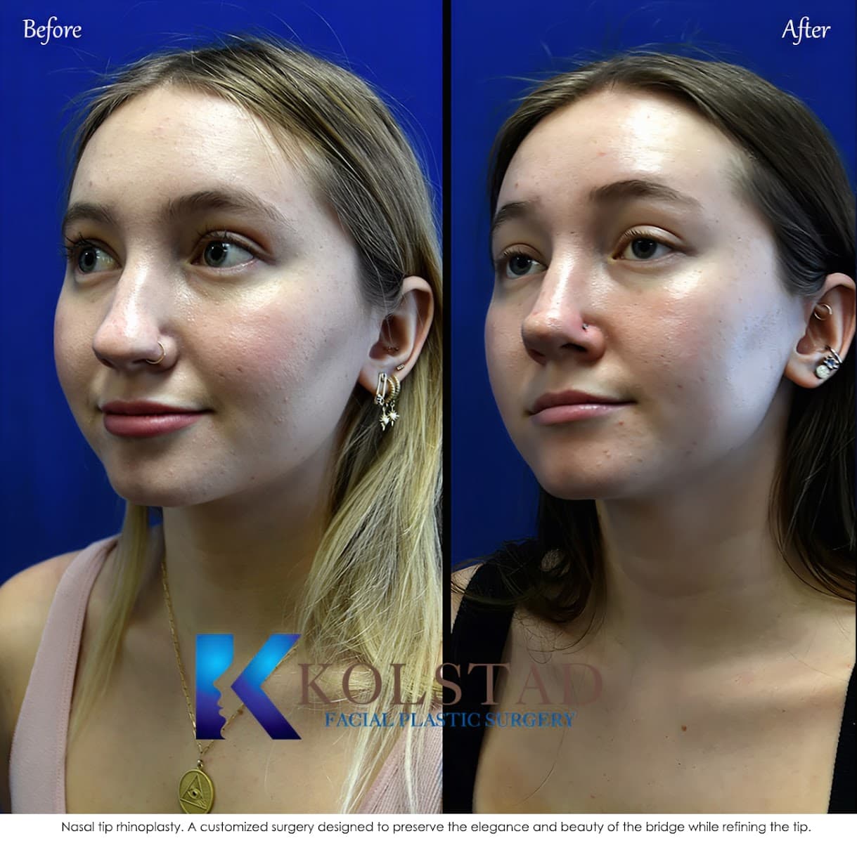 Kolstad Facial Plastic Surgery
