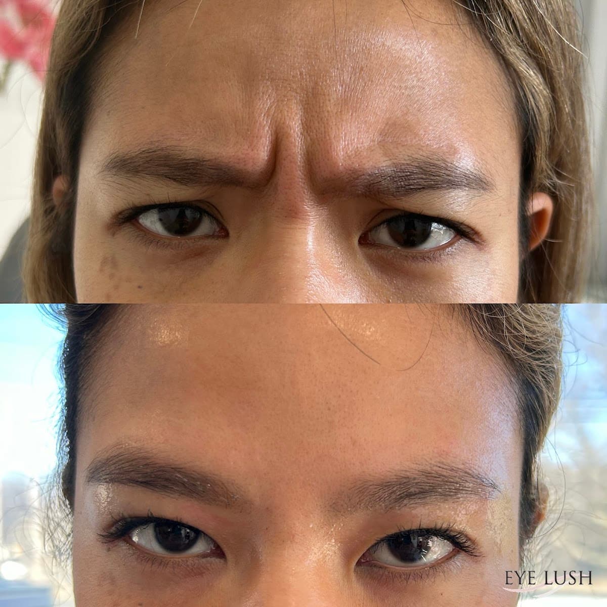 Medilush - (EYE LUSH) photo 1 of 8