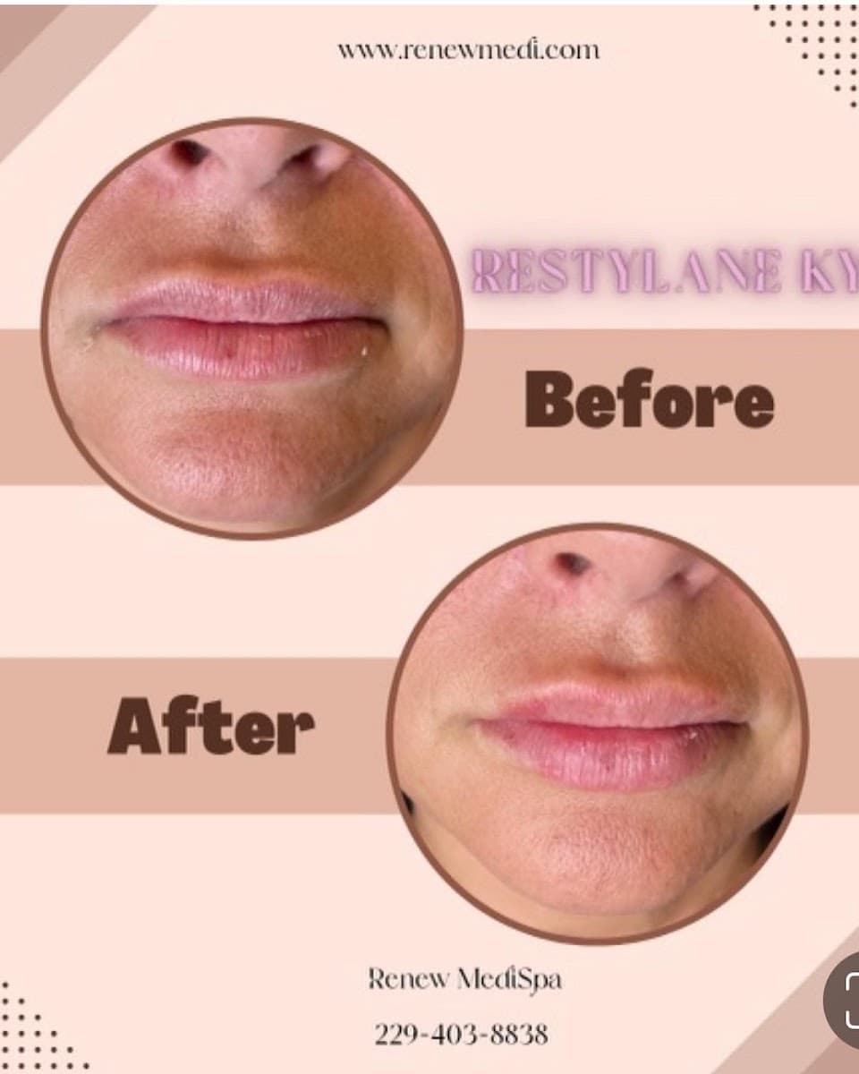 Renew Medispa photo 1 of 8