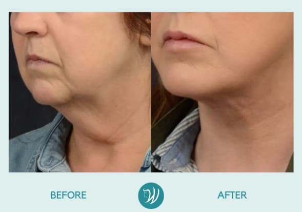 Winslow Facial Plastic Surgery: Catherine Winslow MD