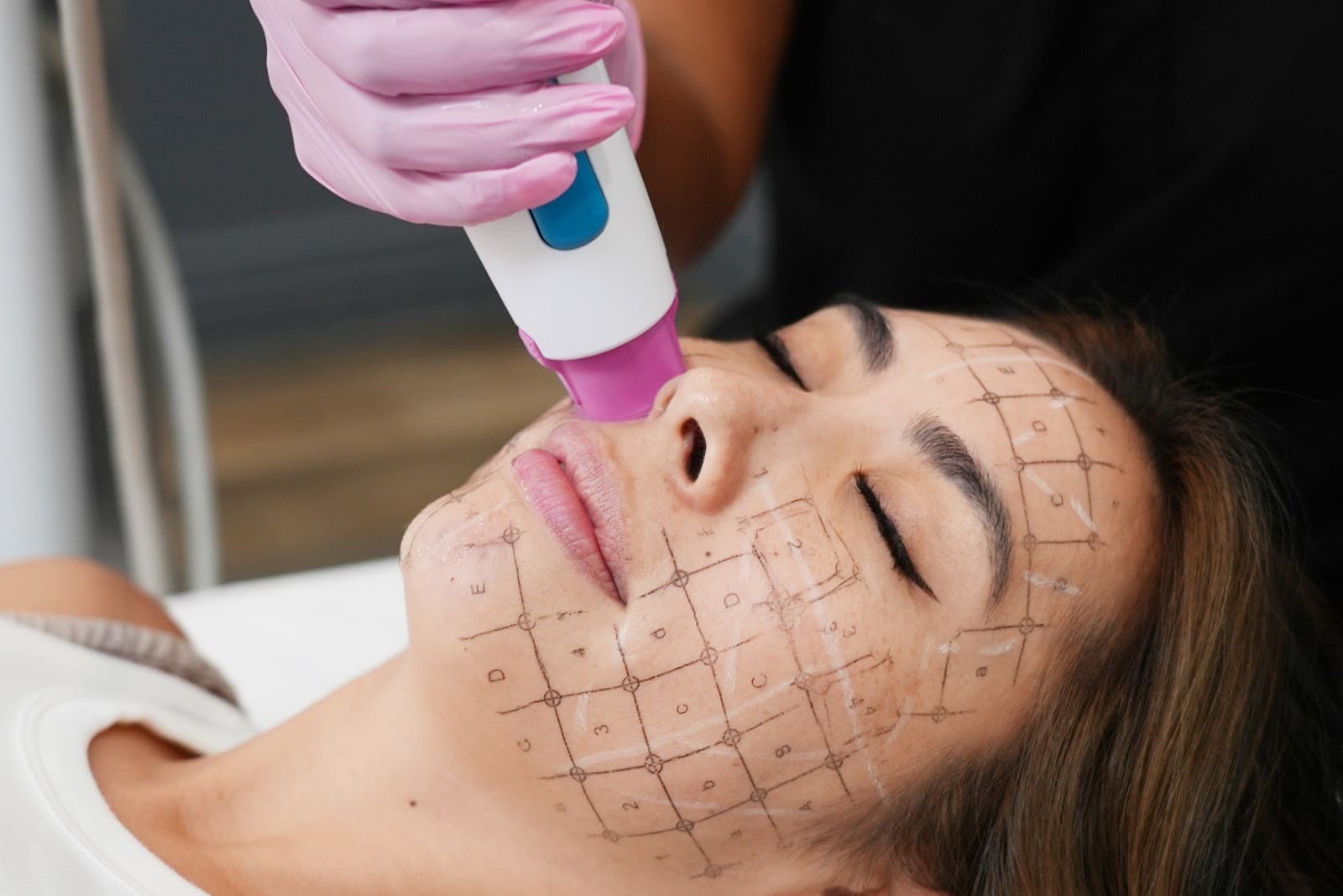 LaserAway Kansas City