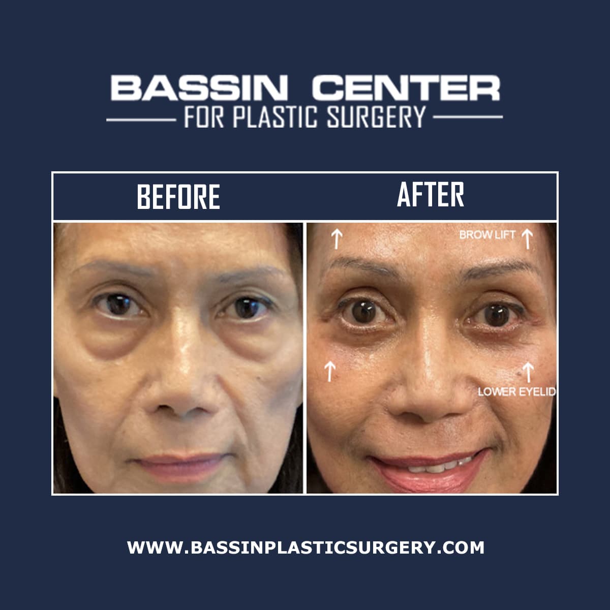 Bassin Center For Plastic Surgery Tampa photo 1 of 8
