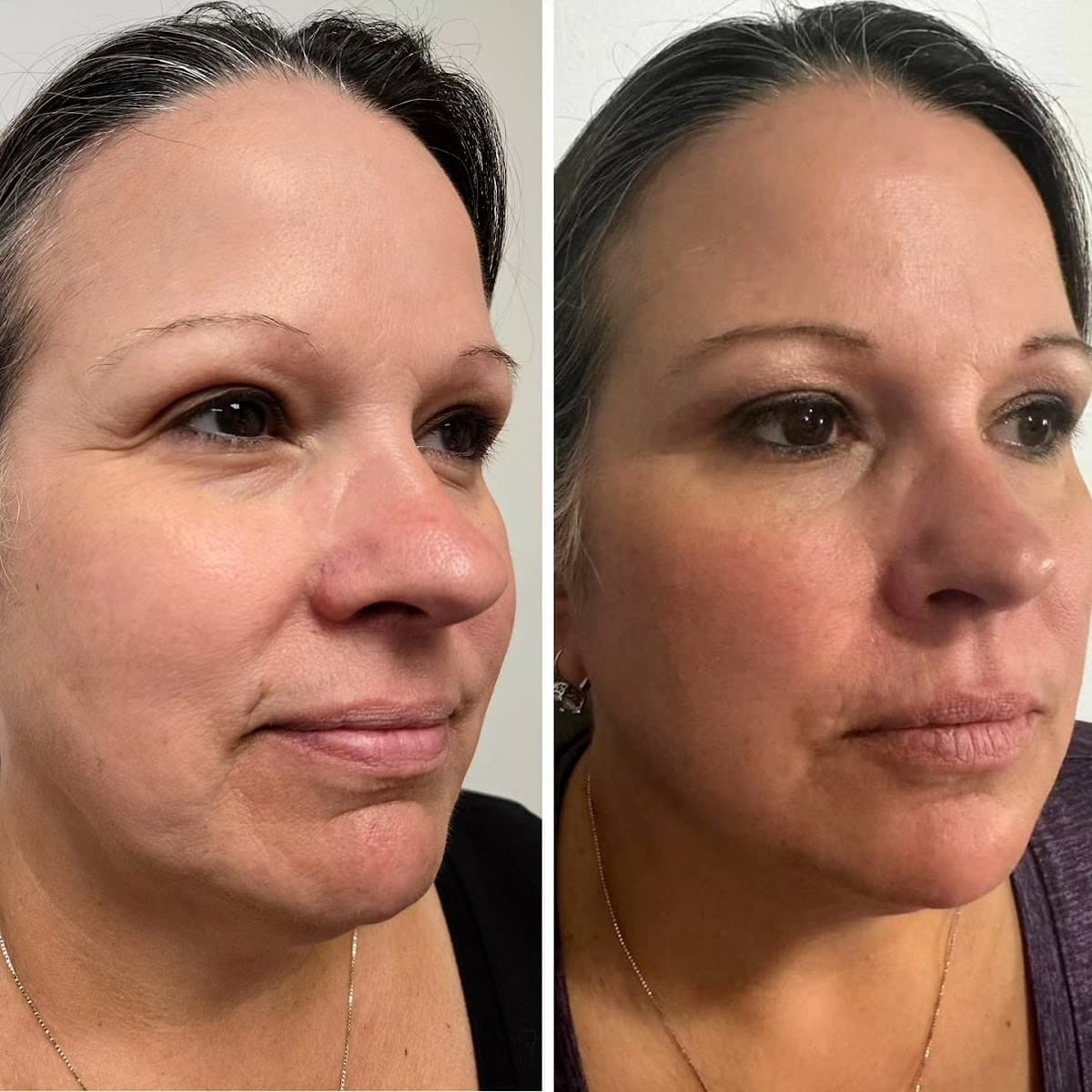 Licata Aesthetics LLC
