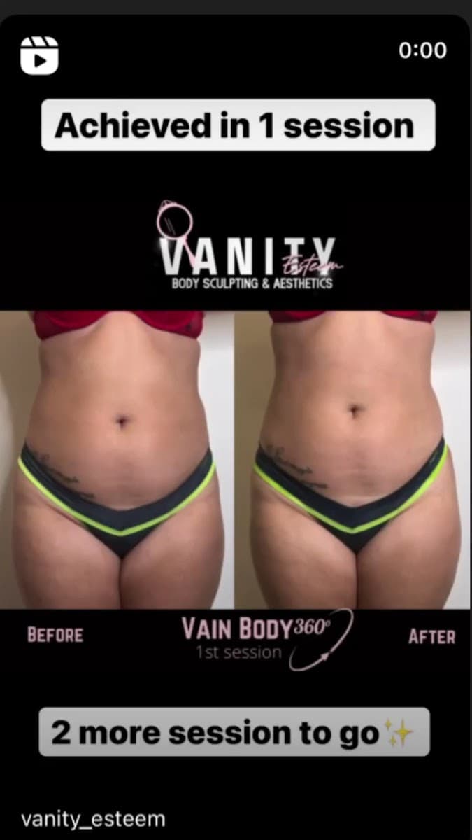 Vanity Esteem Colonics & Body Contouring photo 1 of 7