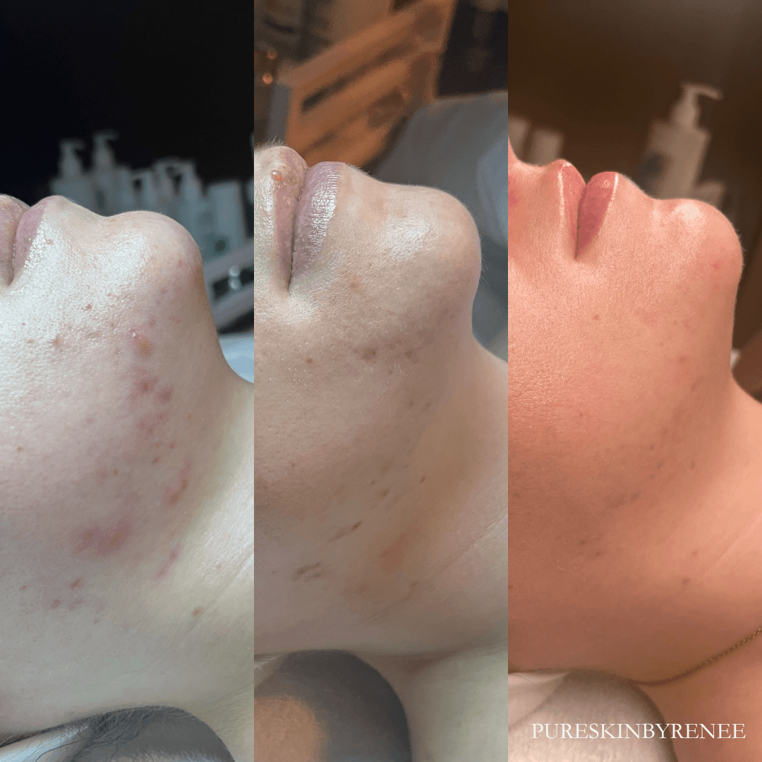 Pure Skin By Renee photo 1 of 7