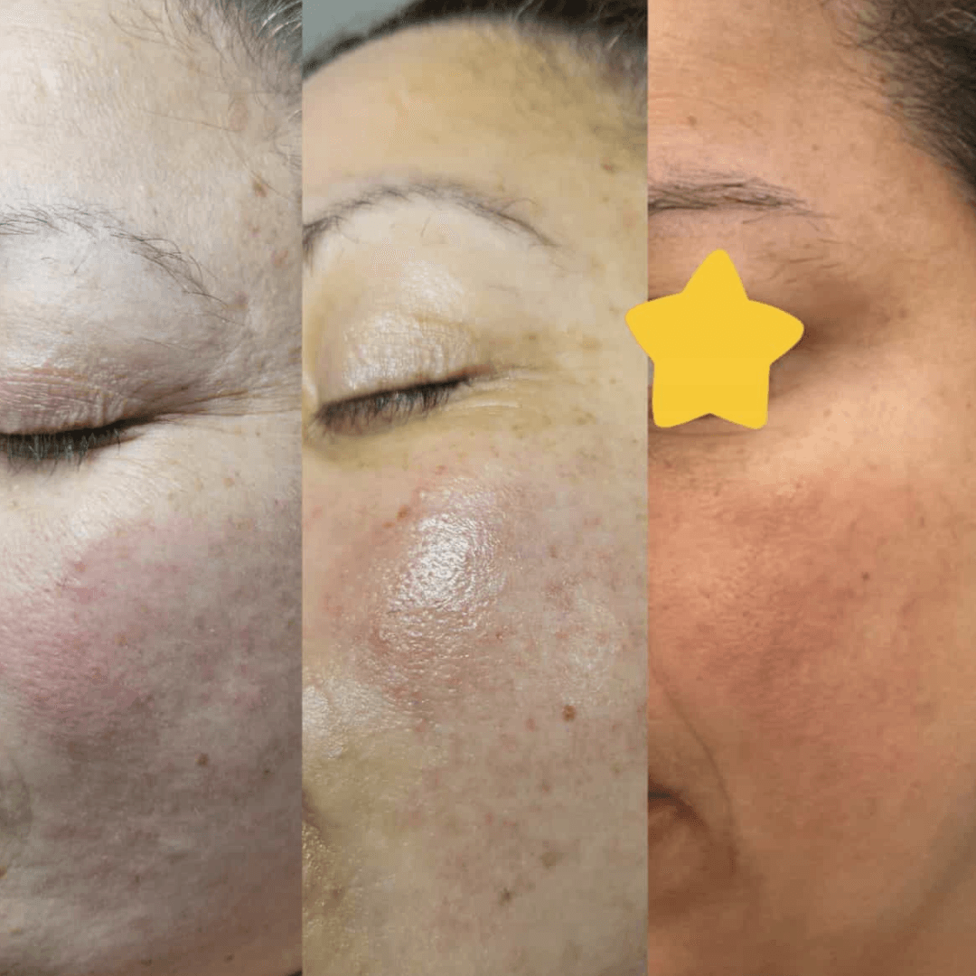 Vital Home Spa | Day Spa , Skin Care Clinic (Springfield)