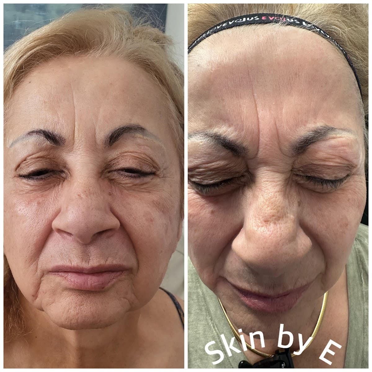 Skin by E LLC photo 1 of 8