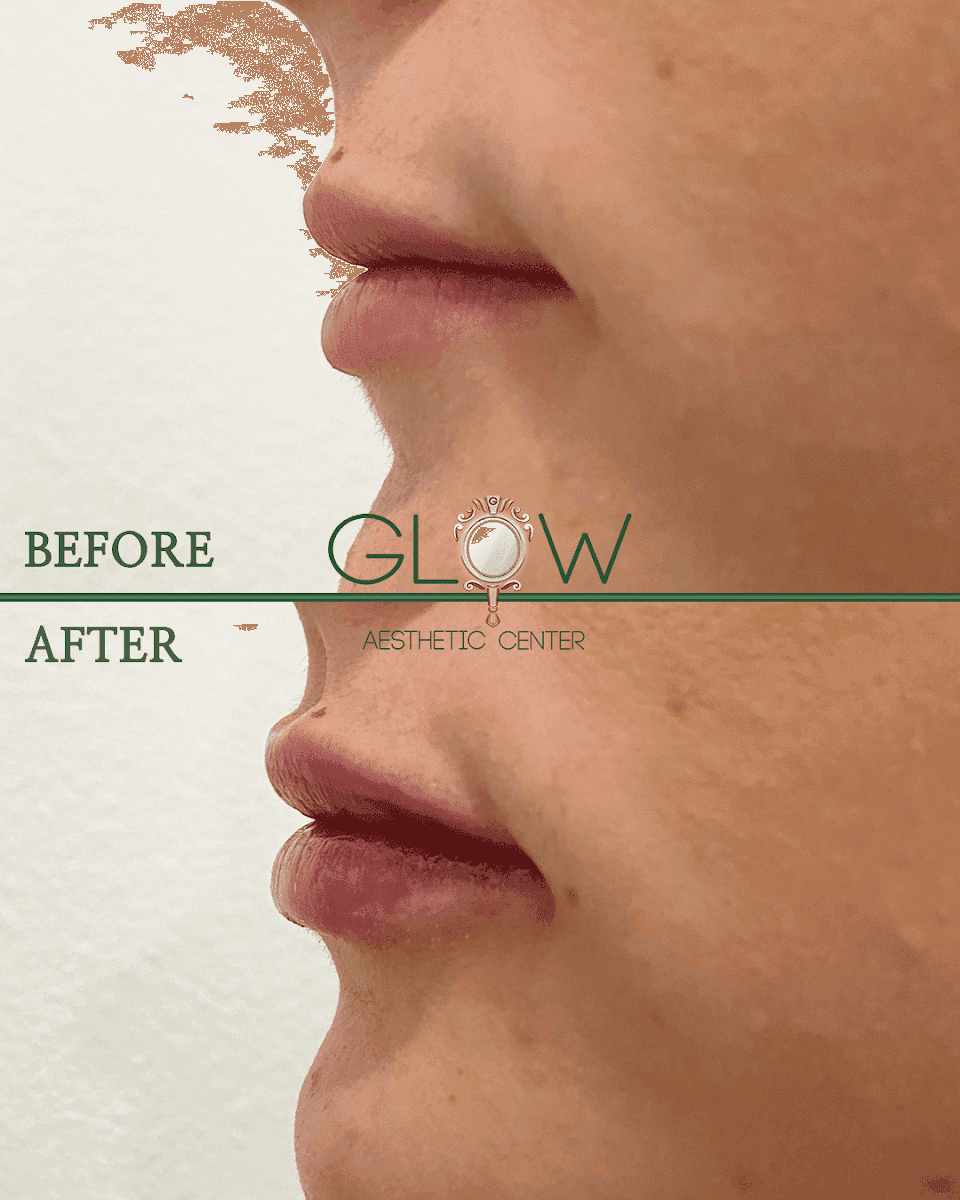 Glow Aesthetic Center Med Spa