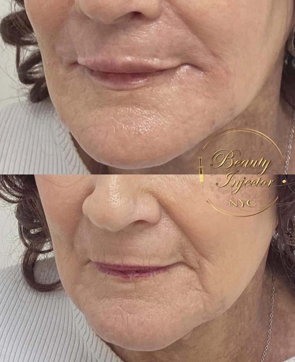 Beauty Injector NYC photo 1 of 6