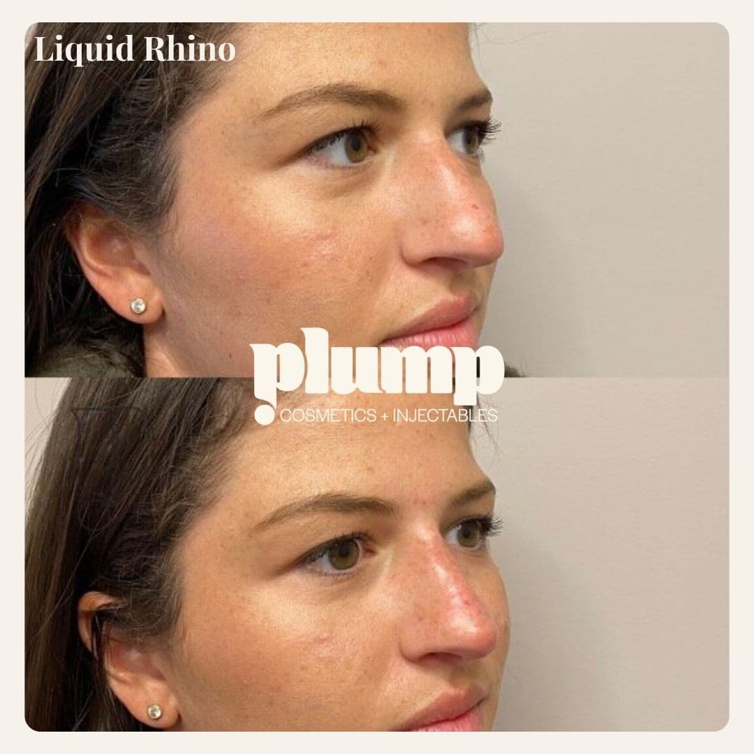 Plump Cosmetics & Injectables photo 1 of 8