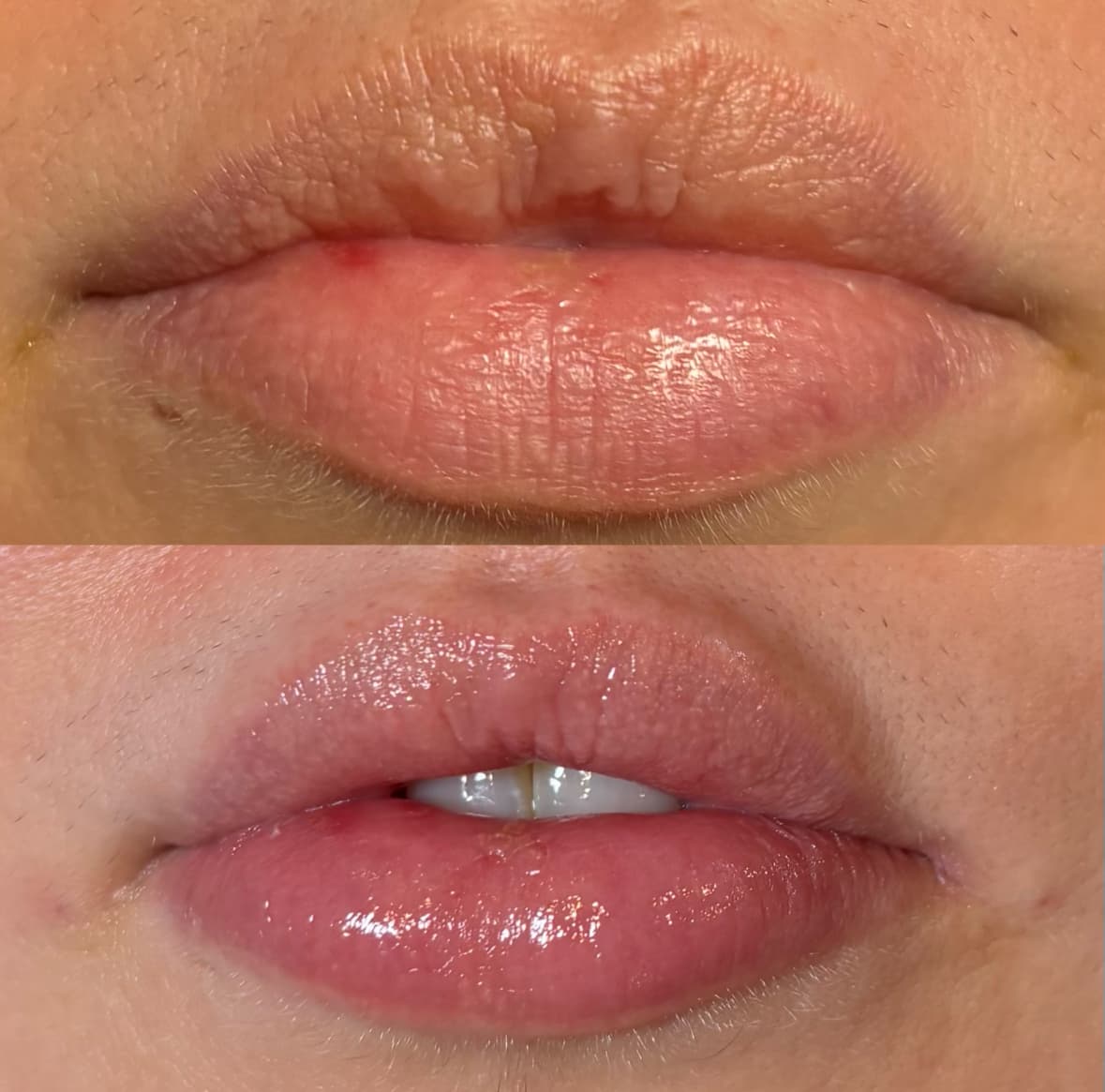 Sheis Beauty Medical Spa
