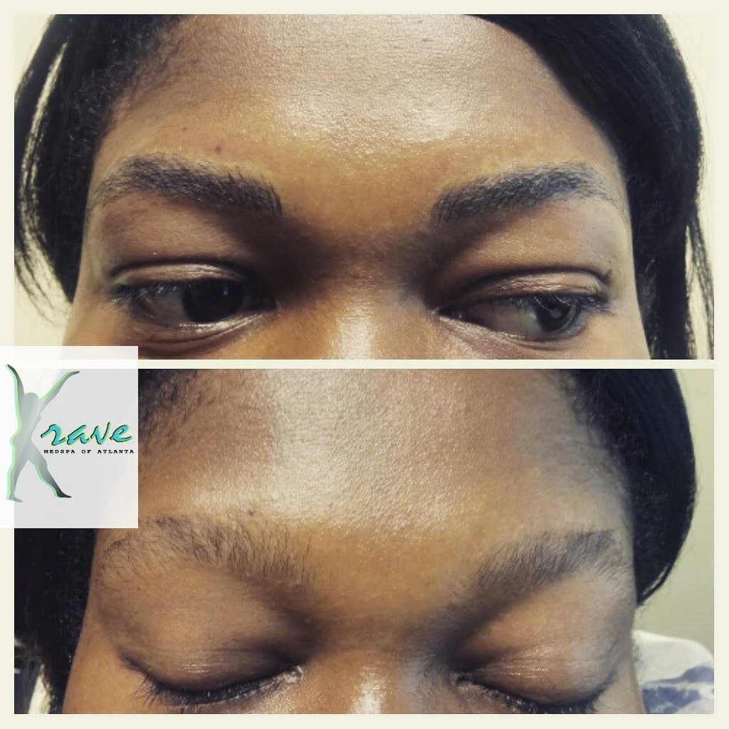 Krave Medspa of Atlanta photo 1 of 4