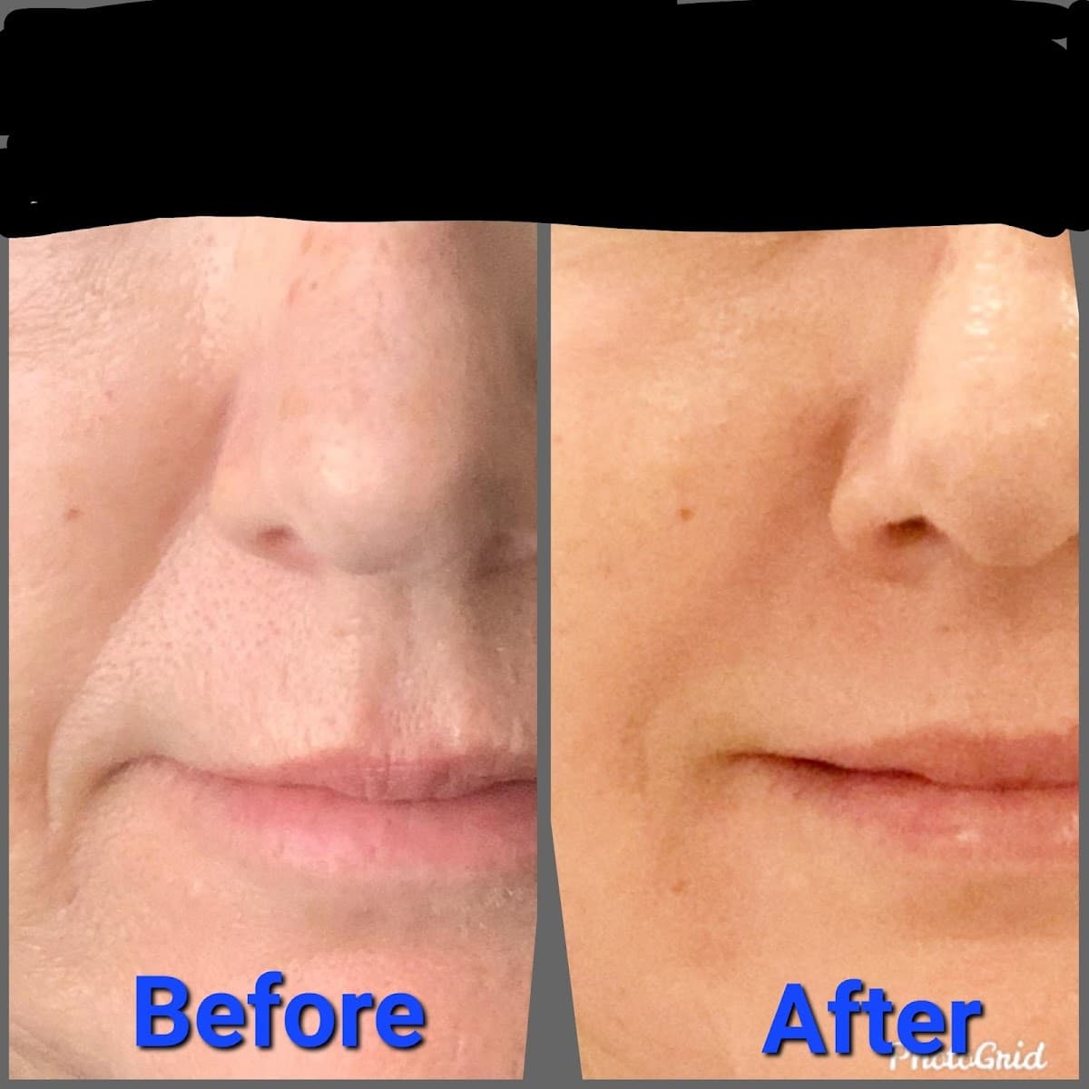 Beauty Resurfaced Med Spa PLLC photo 1 of 8