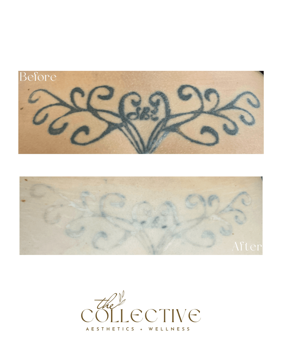 The Collective Aesthetics and Wellness photo 1 of 8