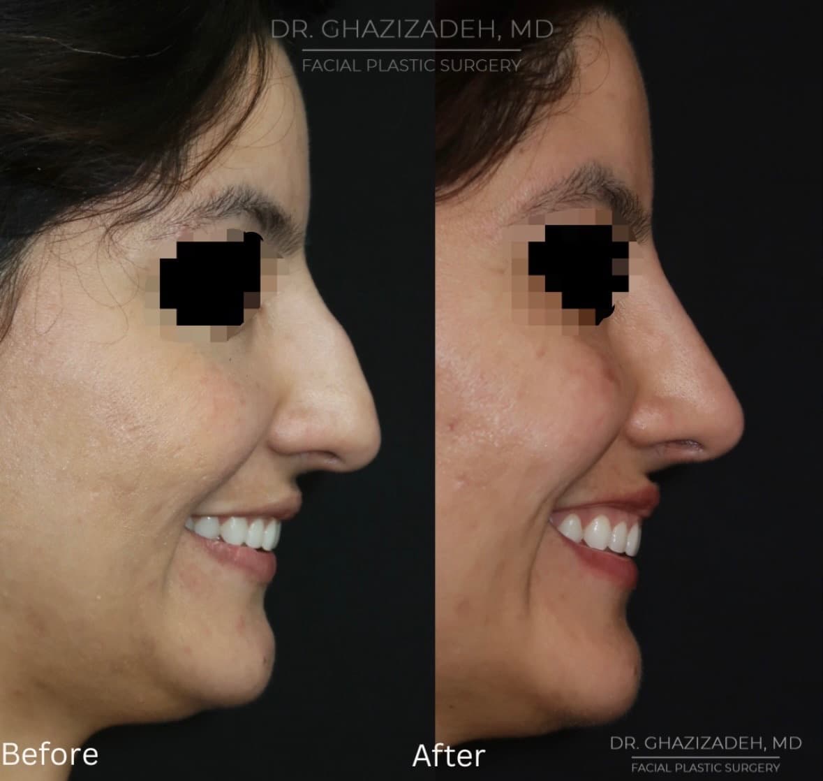 Dr. Shabnam Ghazizadeh MD, Facial Plastic Surgery