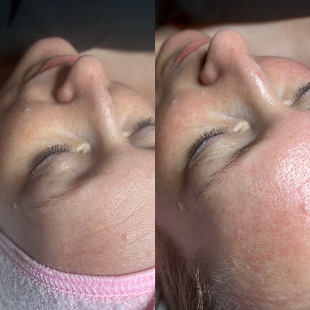 Glow Facial Studio by Michelle, LLC photo 1 of 8