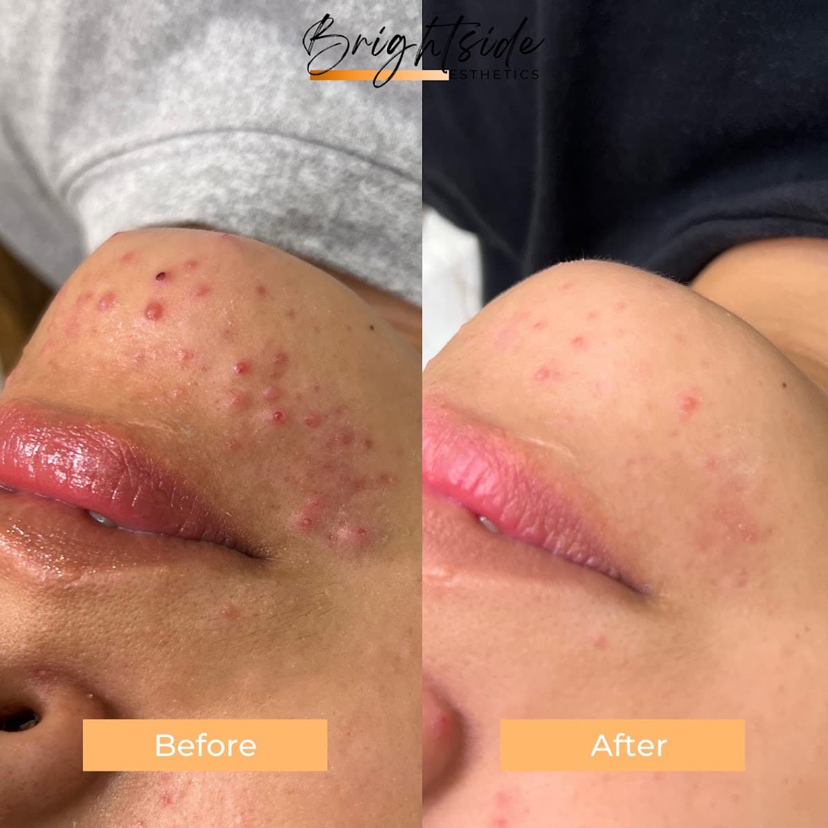 Brightside Esthetics - Facials & Waxing in Huntington Beach