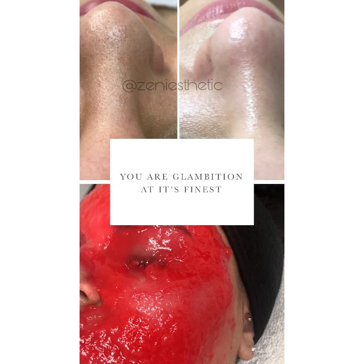 Zeni Esthetic LLC