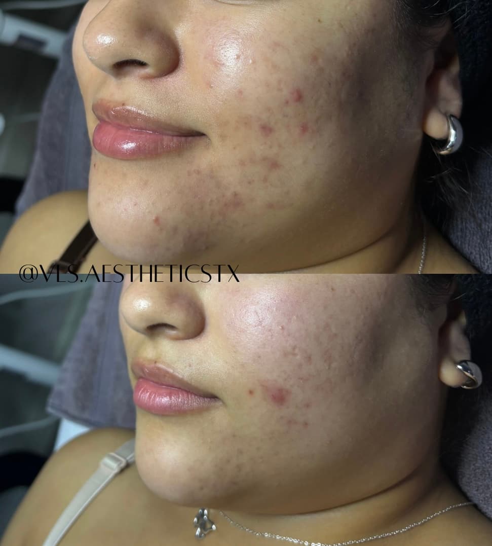 VLS Aesthetics LLC