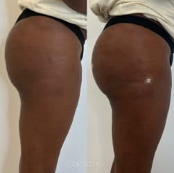 Akeso Aesthetics and Wellness