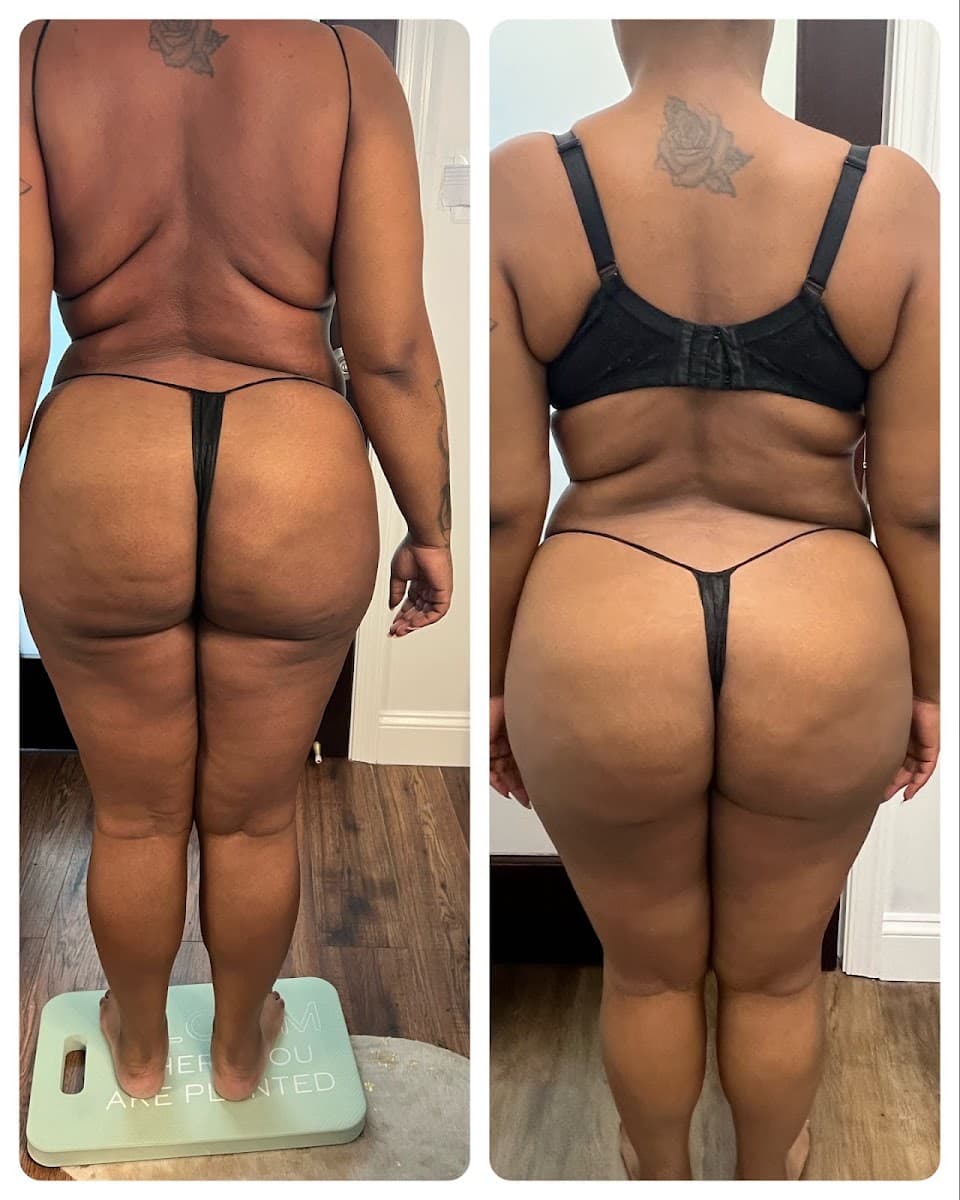 Demure Skin and Body Sculpting