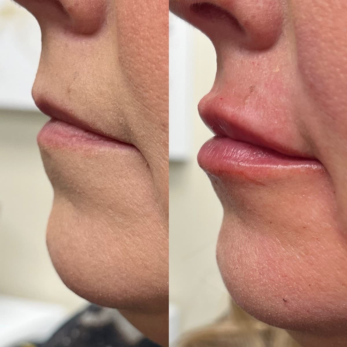 Pinnacle Aesthetics at Holsey Cosmetic Surgery photo 1 of 7