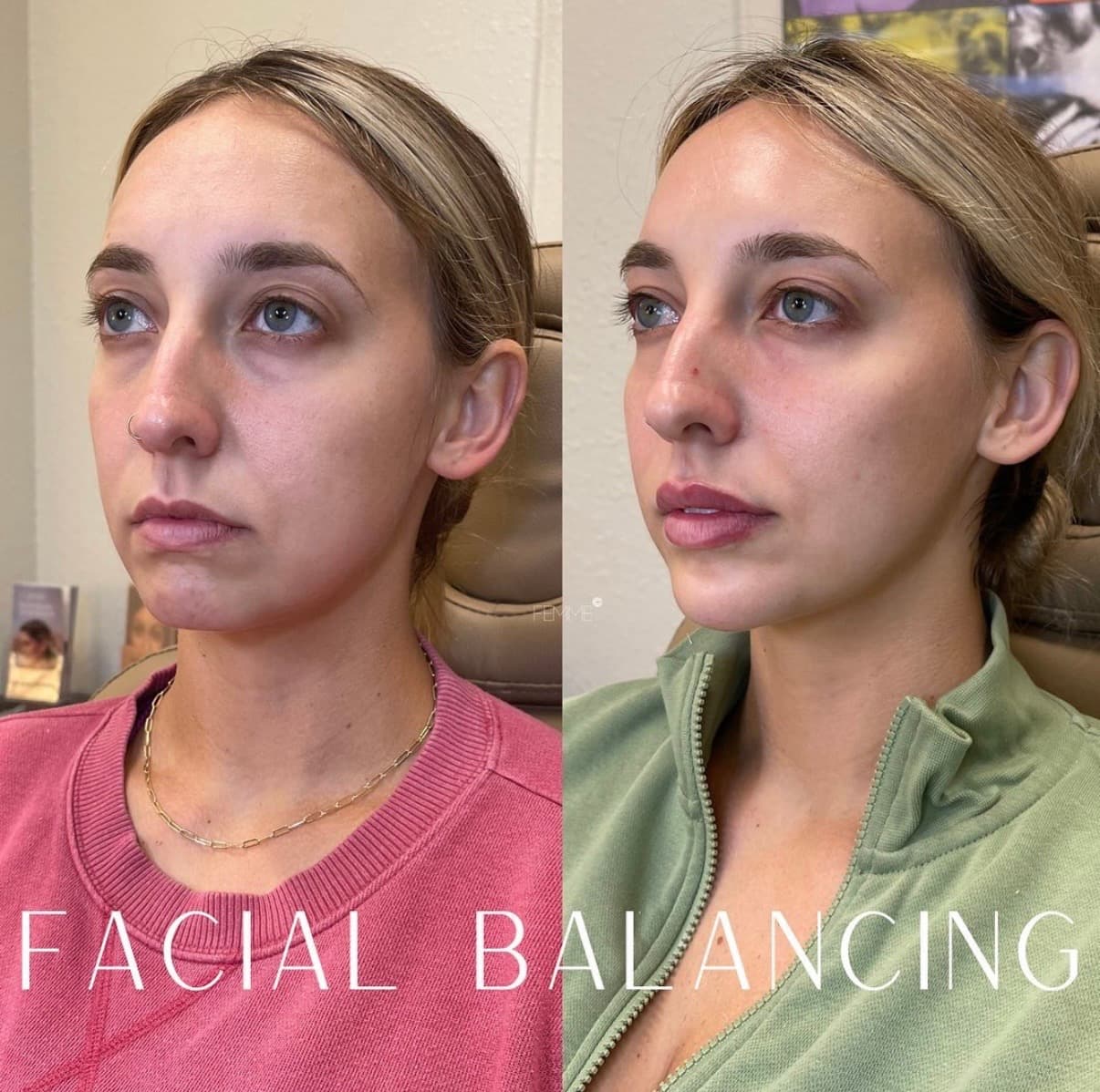 Femme Medspa photo 1 of 8