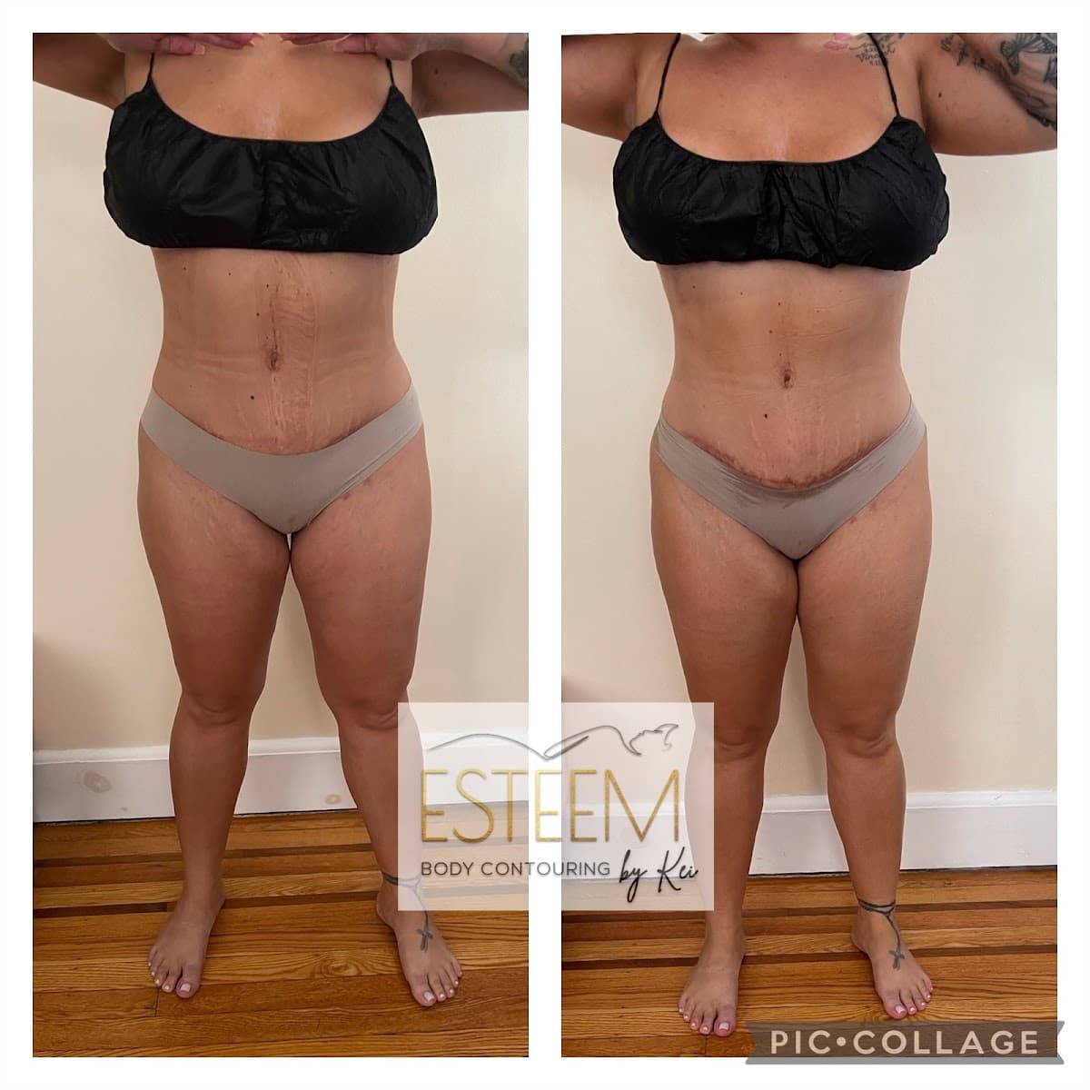 Esteem Body Contour By Kei