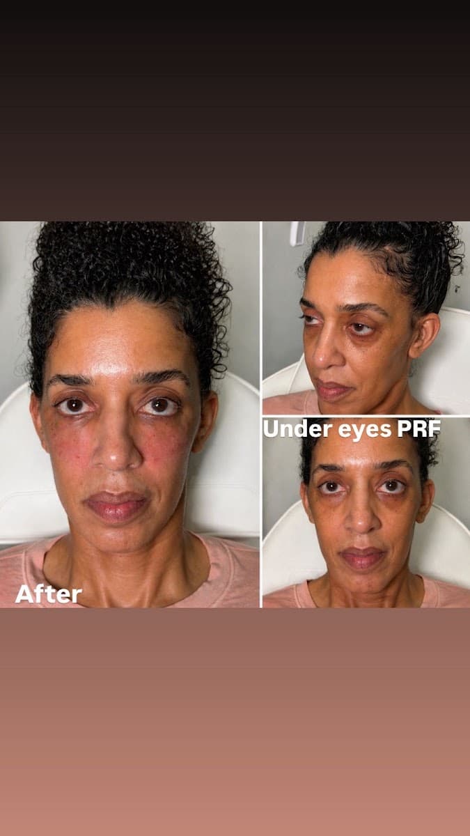 Mila’s aesthetic Med spa