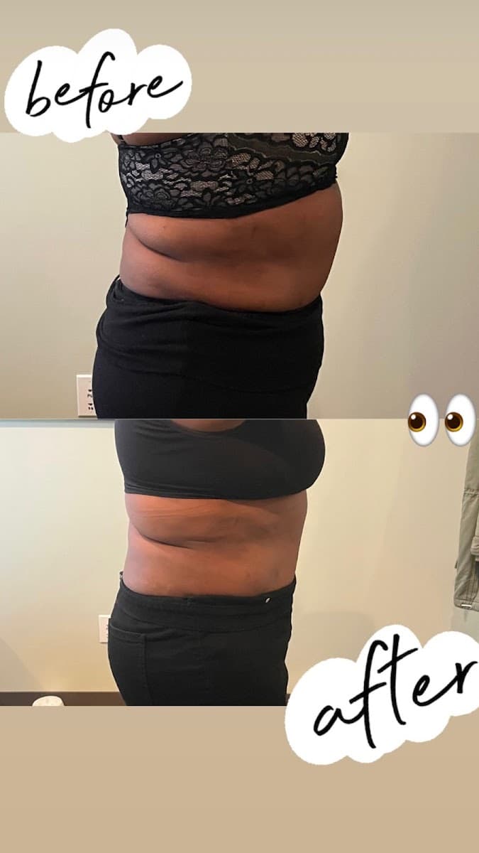Love Your Body Cavi-Lipo
