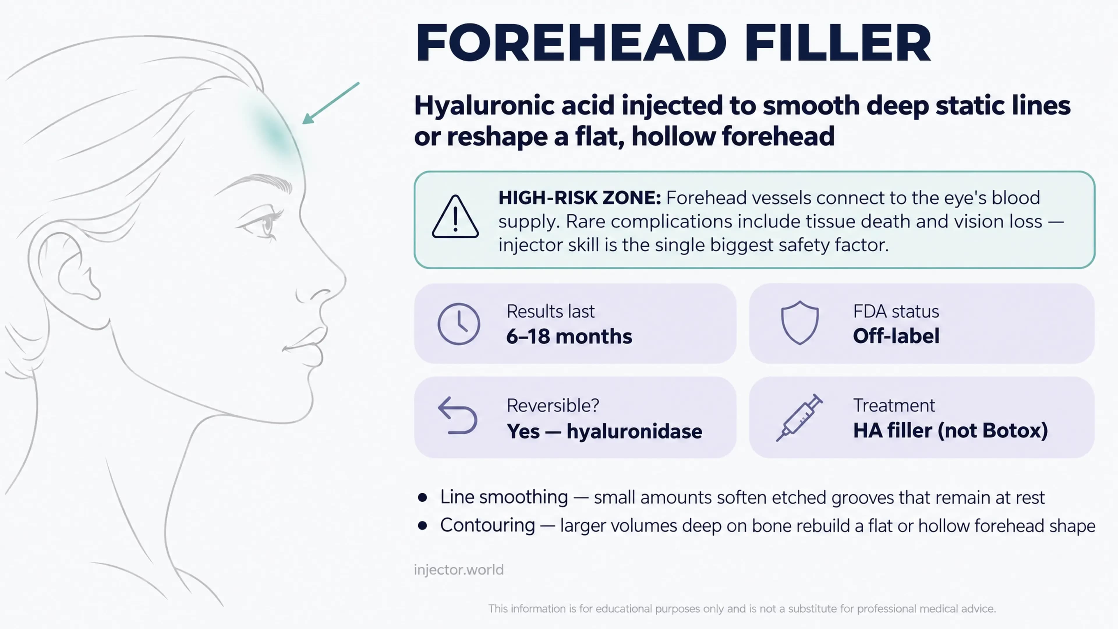 Forehead Filler: Benefits, Risks, Cost and Results (2026)