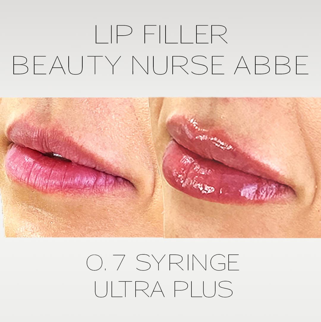 Beauty Nurse Abbe photo 2
